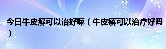 今日牛皮癣可以治好嘛（牛皮癣可以治疗好吗）