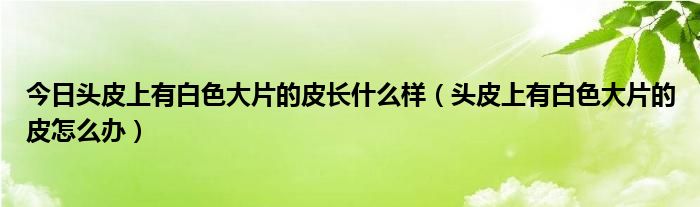 今日头皮上有白色大片的皮长什么样（头皮上有白色大片的皮怎么办）