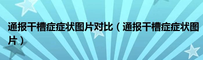 通报干槽症症状图片对比（通报干槽症症状图片）